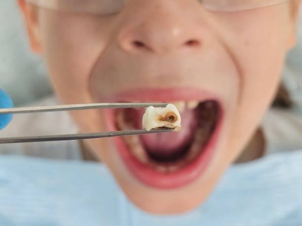 Best Emergency Dental Services for Seniors in Florida, NY